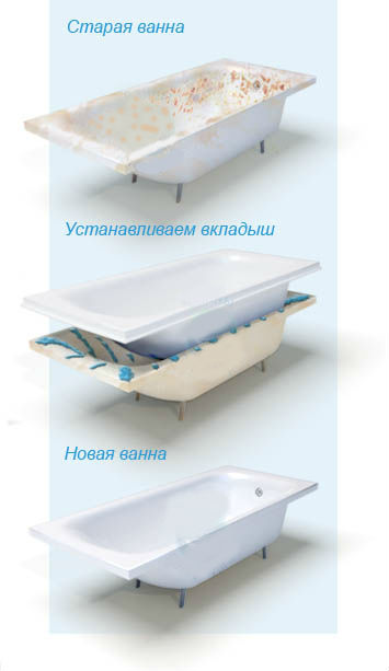 Установка акрилового вкладыша